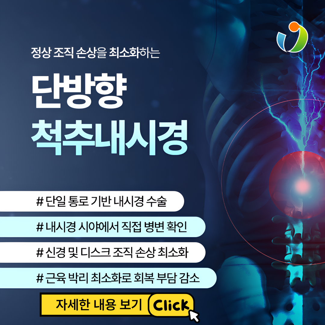 3 단방향
