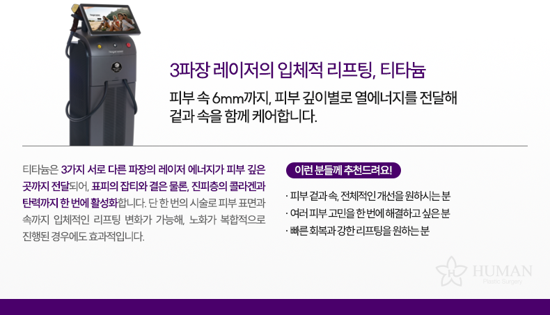 1-9_티타늄_설명