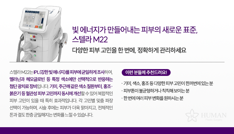 2-4_stellar-M22_설명