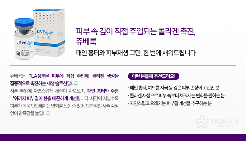 3-1_쥬베룩_설명