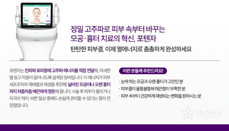 3-2_포텐자_설명