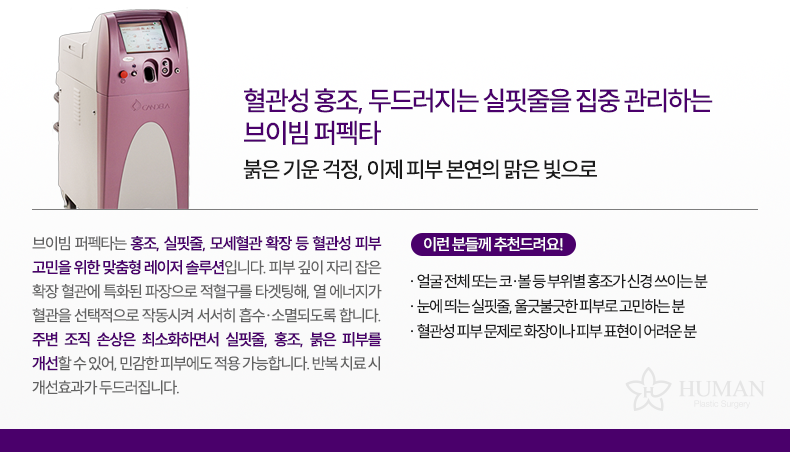 4-1_브이빔_설명