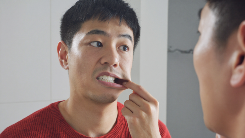 스케일링 후 치아 사이 구멍을 거울로 확인하는 모습