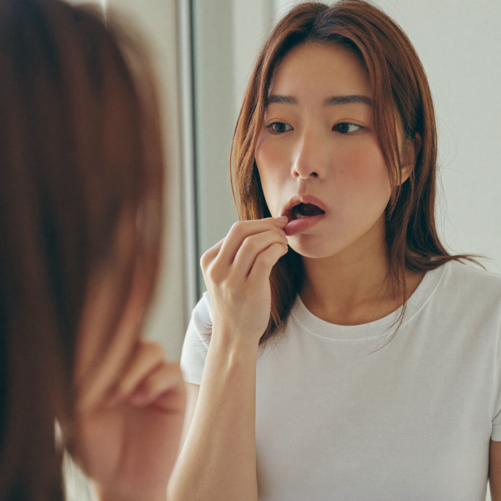 거울로 입안에 생긴 구내염을 확인하는 모습