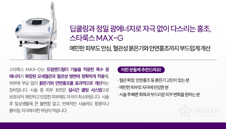 3-8_스타룩스_설명