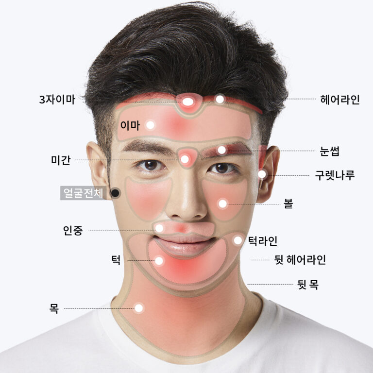 남성레이저제모 - VS라인 인천구월점